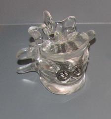 Vertabral Augmentation Implants, Thoracolumbar Cages