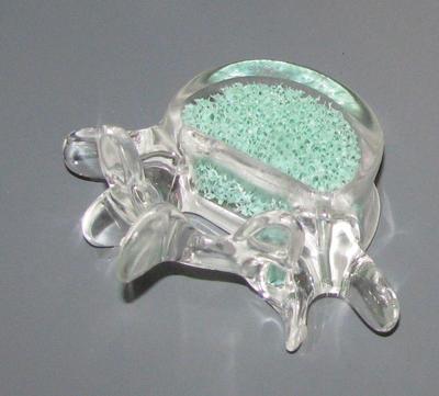 Vertabral Augmentation Equipment, Bone Cement