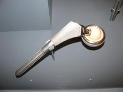 Artificial Hip