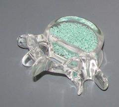 Vertabral Augmentation Equipment, Bone Cement