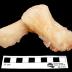 Stilbite